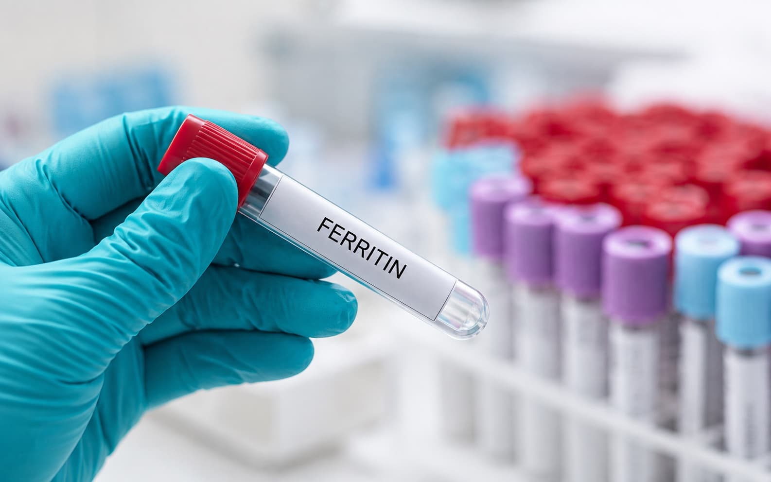 A laboratory professional holding a blood sample tube labelled ferritin beside rows of collection tubes