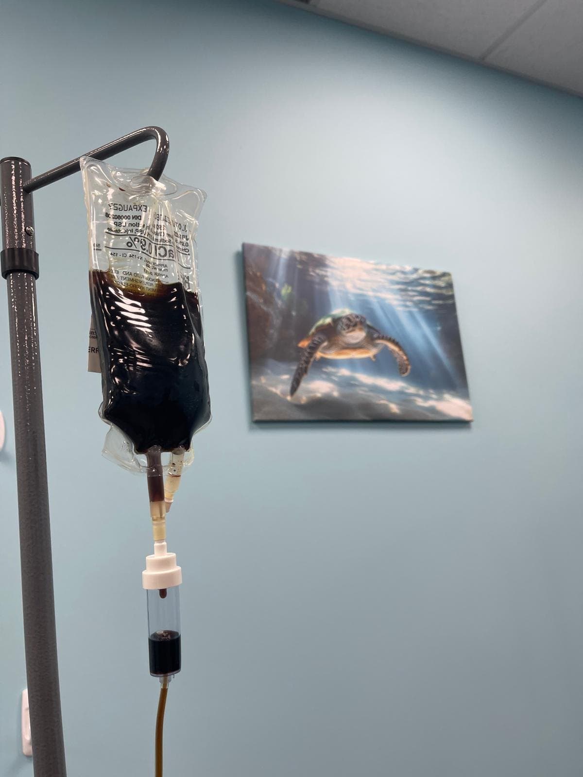 Iron infusion bag on an IV pole in a treatment room at Solis Medical Clinic in Edmonton