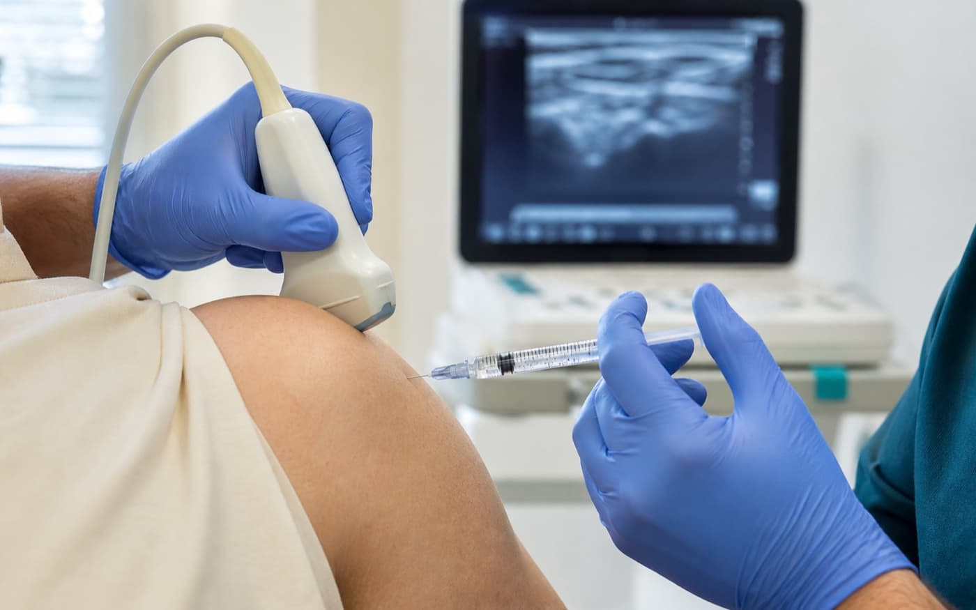Gloved hands using ultrasound to guide a prolotherapy injection near a shoulder tendon